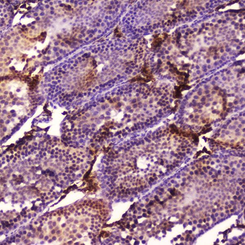 Cytochrome P450 17A1/Cyp17a1 Rabbit Polyclonal Antibody