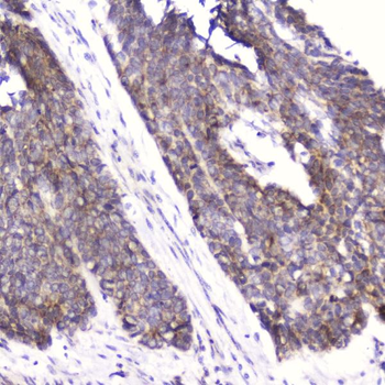 Cardiac FABP/FABP3 Rabbit Polyclonal Antibody