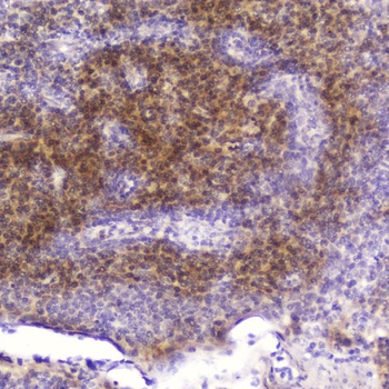 Cardiac FABP/FABP3 Rabbit Polyclonal Antibody