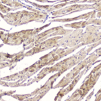 Cardiac FABP/FABP3 Rabbit Polyclonal Antibody
