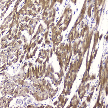 Cardiac FABP/FABP3 Rabbit Polyclonal Antibody