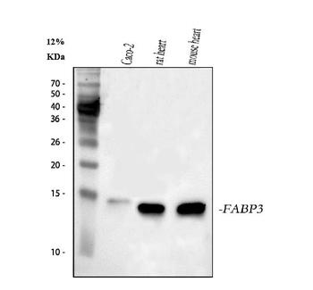 Cardiac FABP/FABP3 Rabbit Polyclonal Antibody
