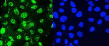 Hsp105/HSPH1 Rabbit Polyclonal Antibody