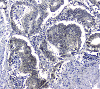 Hsp105/HSPH1 Rabbit Polyclonal Antibody