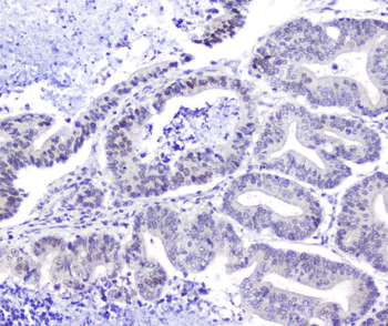 Hsp105/HSPH1 Rabbit Polyclonal Antibody