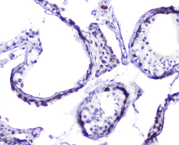 Hsp105/HSPH1 Rabbit Polyclonal Antibody