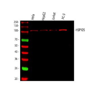 Hsp105/HSPH1 Rabbit Polyclonal Antibody