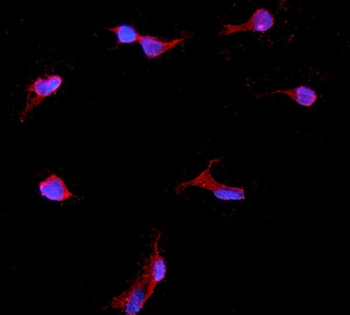 IGFBP2 Rabbit Polyclonal Antibody