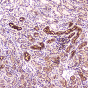IGFBP2 Rabbit Polyclonal Antibody