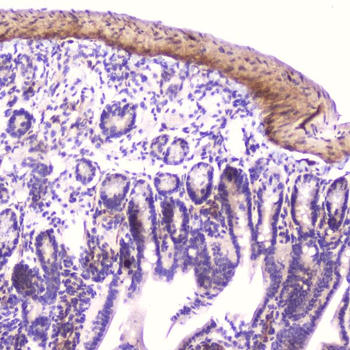 IGFBP2 Rabbit Polyclonal Antibody