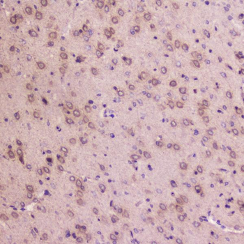IGFBP2 Rabbit Polyclonal Antibody