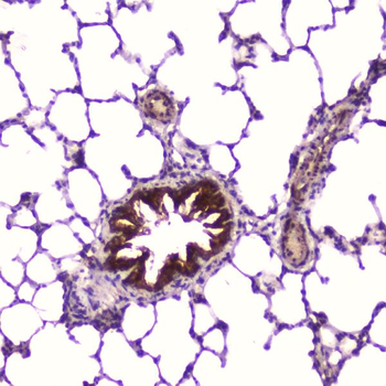 IGFBP2 Rabbit Polyclonal Antibody