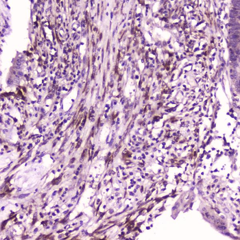 IL36 alpha/IL36A Rabbit Polyclonal Antibody