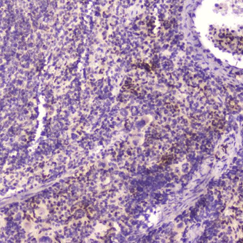 KLF4 Rabbit Polyclonal Antibody