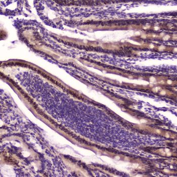 KLF4 Rabbit Polyclonal Antibody