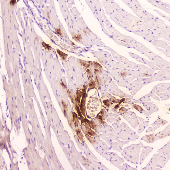 ANP/Nppa Rabbit Polyclonal Antibody