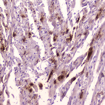 ANP/Nppa Rabbit Polyclonal Antibody