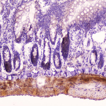 ANP/Nppa Rabbit Polyclonal Antibody