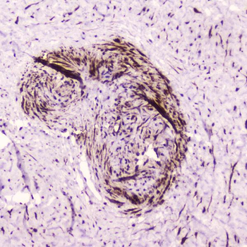 PDGF Receptor beta/PDGFRB Rabbit Polyclonal Antibody