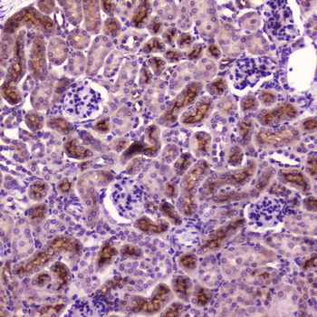 PDGF Receptor beta/PDGFRB Rabbit Polyclonal Antibody