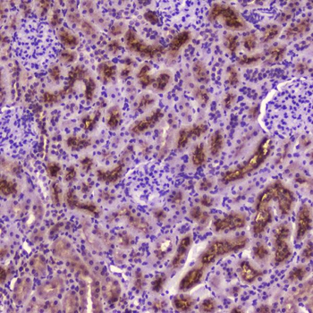 PDGF Receptor beta/PDGFRB Rabbit Polyclonal Antibody