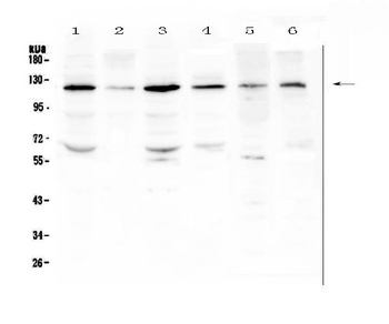 PDGF Receptor beta/PDGFRB Rabbit Polyclonal Antibody