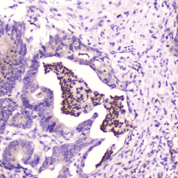 SPARCL1 Rabbit Polyclonal Antibody