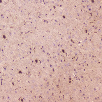 SPARCL1 Rabbit Polyclonal Antibody