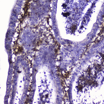 Talin 1/TLN1 Rabbit Polyclonal Antibody