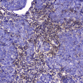 Talin 1/TLN1 Rabbit Polyclonal Antibody
