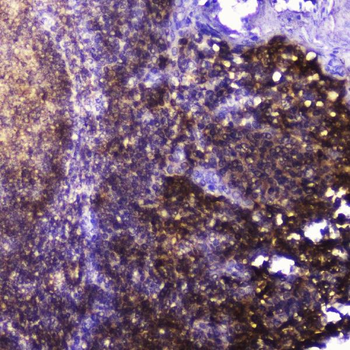 Talin 1/TLN1 Rabbit Polyclonal Antibody