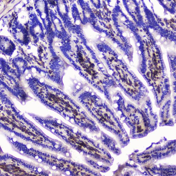 Talin 1/TLN1 Rabbit Polyclonal Antibody