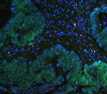 TPR Rabbit Polyclonal Antibody