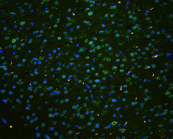 TPR Rabbit Polyclonal Antibody