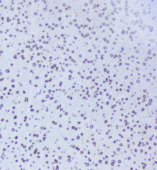 TPR Rabbit Polyclonal Antibody