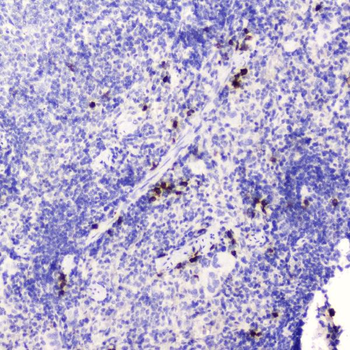 HE4/WFDC2 Rabbit Polyclonal Antibody