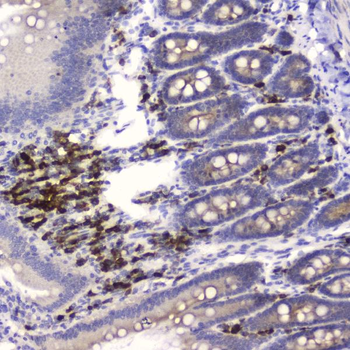 HE4/WFDC2 Rabbit Polyclonal Antibody