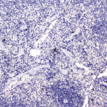 HE4/WFDC2 Rabbit Polyclonal Antibody