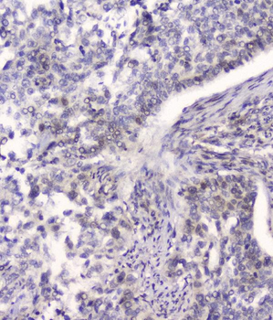 HSPA2 Mouse Monoclonal Antibody
