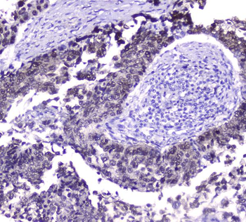 Hsp70 HSPA1A Mouse Monoclonal Antibody