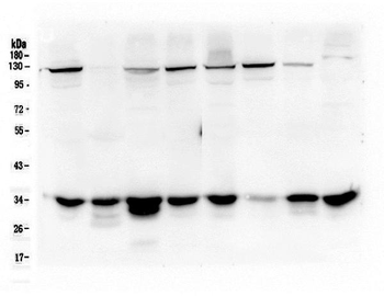 AMPK beta 2 PRKAB2 Mouse Monoclonal Antibody