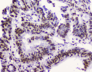 RbAp48 RBBP4 Mouse Monoclonal Antibody