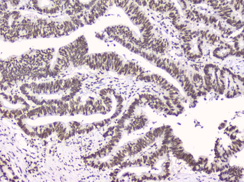 RbAp48 RBBP4 Mouse Monoclonal Antibody