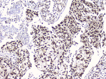 RbAp48 RBBP4 Mouse Monoclonal Antibody