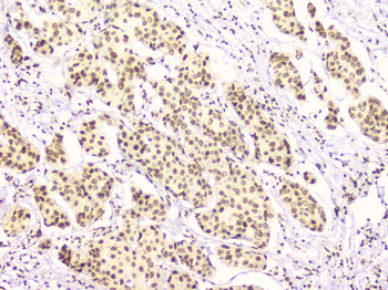 RbAp48 RBBP4 Mouse Monoclonal Antibody