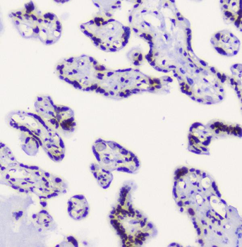 RbAp48 RBBP4 Mouse Monoclonal Antibody