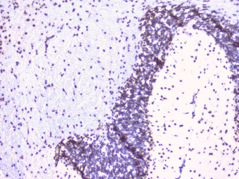 RbAp48 RBBP4 Mouse Monoclonal Antibody