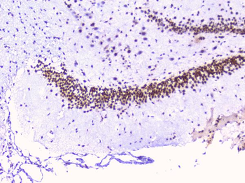RbAp48 RBBP4 Mouse Monoclonal Antibody