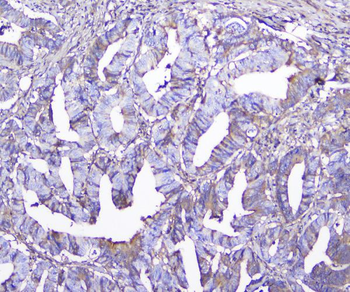 GSTM1 Mouse Monoclonal Antibody