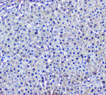 GSTM1 Mouse Monoclonal Antibody